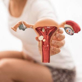 Endometriosis Treatment