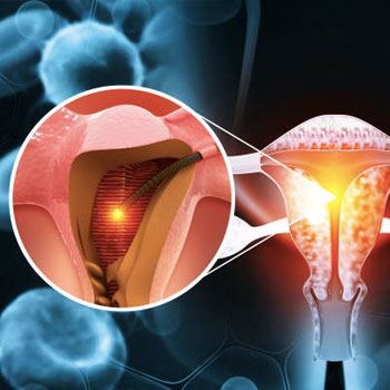 Tuboplasty treatement in Krishna Hospital